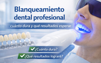 Blanqueamiento dental profesional: cuánto dura y qué resultados esperar
